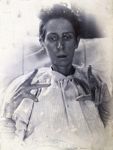 800px-Friern_Hospital,_London;_a_woman_suffering_from_mania,_with_Wellcome_V0029627.jpg